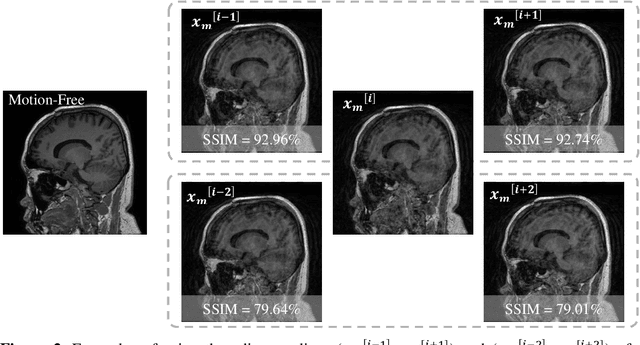 Figure 3 for Stacked U-Nets with Self-Assisted Priors Towards Robust Correction of Rigid Motion Artifact in Brain MRI