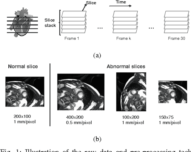 Figure 1 for Estimation of the volume of the left ventricle from MRI images using deep neural networks