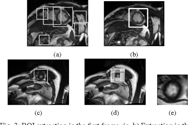 Figure 4 for Estimation of the volume of the left ventricle from MRI images using deep neural networks