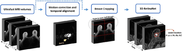 Figure 1 for Automatic Breast Lesion Detection in Ultrafast DCE-MRI Using Deep Learning