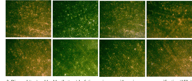 Figure 3 for Detection of sub-cellular changes by use of $λ=6.5$ micron laser light interaction in association with Intelligent Laser Speckle Classification (ILSC) technique