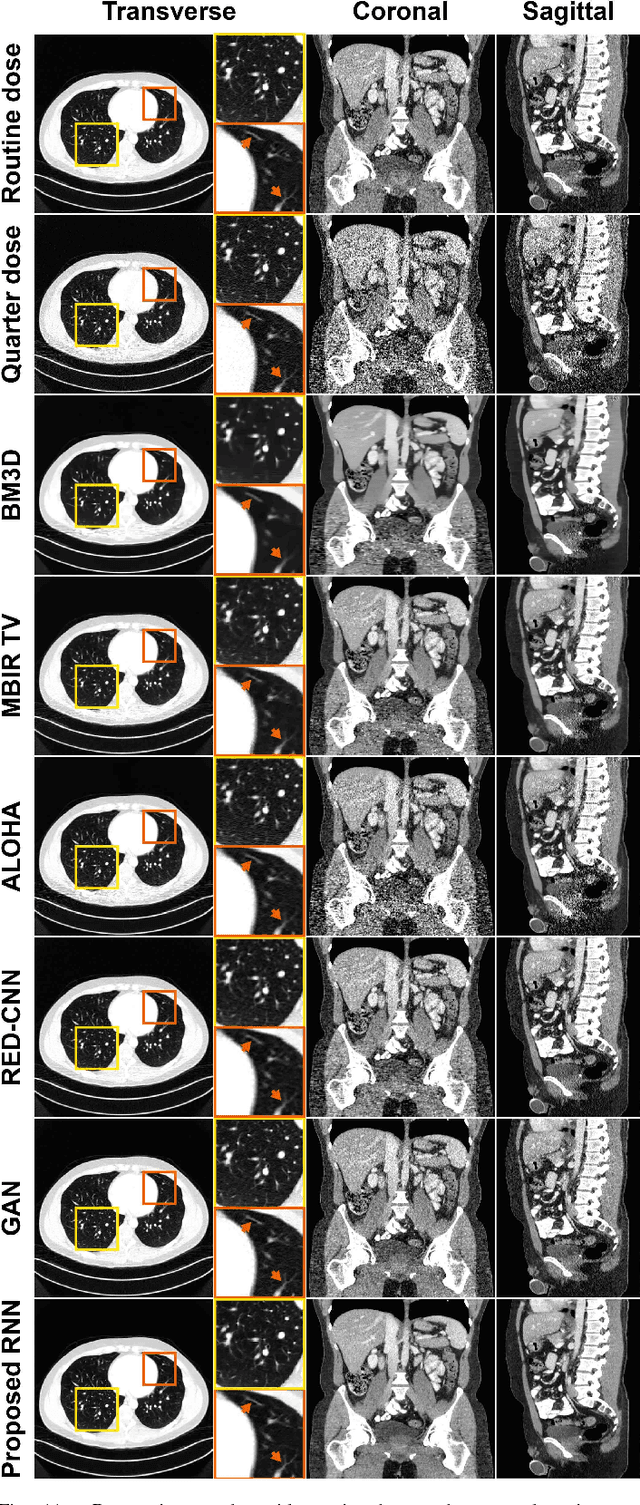 Figure 3 for Deep Convolutional Framelet Denosing for Low-Dose CT via Wavelet Residual Network