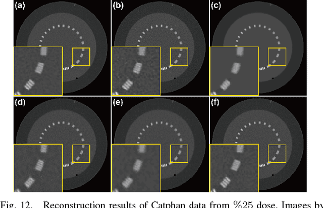 Figure 4 for Deep Convolutional Framelet Denosing for Low-Dose CT via Wavelet Residual Network