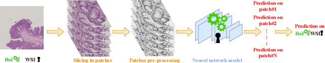 Figure 2 for Dysplasia grading of colorectal polyps through CNN analysis of WSI