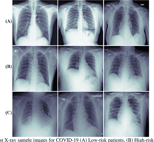 Figure 3 for BIO-CXRNET: A Robust Multimodal Stacking Machine Learning Technique for Mortality Risk Prediction of COVID-19 Patients using Chest X-Ray Images and Clinical Data