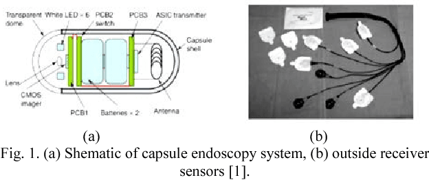 Figure 1 for Lossless Image Compression Algorithm for Wireless Capsule Endoscopy by Content-Based Classification of Image Blocks