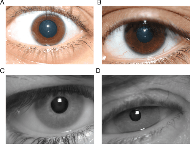 Figure 3 for A Robust Iris Authentication System on GPU-Based Edge Devices using Multi-Modalities Learning Model