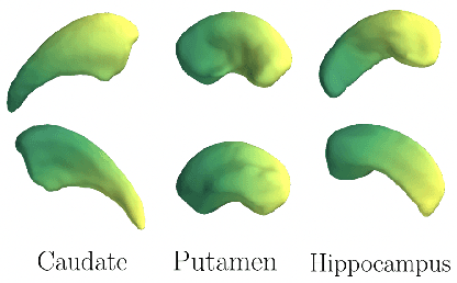 Figure 3 for A Convolutional Autoencoder Approach to Learn Volumetric Shape Representations for Brain Structures