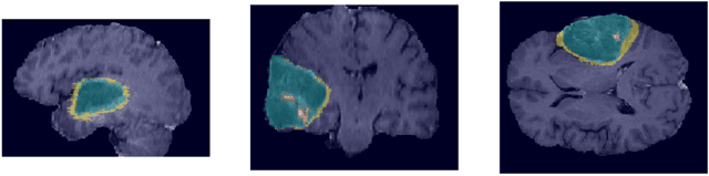 Figure 1 for Vox2Vox: 3D-GAN for Brain Tumour Segmentation