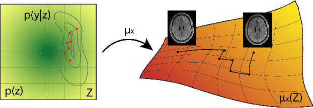 Figure 1 for Sampling possible reconstructions of undersampled acquisitions in MR imaging