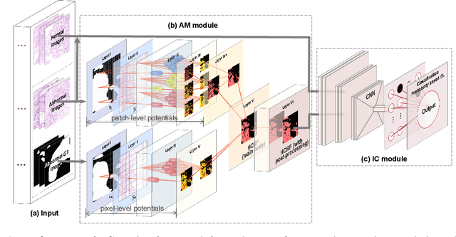 Figure 3 for A Hierarchical Conditional Random Field-based Attention Mechanism Approach for Gastric Histopathology Image Classification