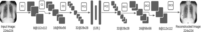 Figure 2 for COVIDomaly: A Deep Convolutional Autoencoder Approach for Detecting Early Cases of COVID-19