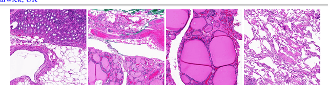 Figure 1 for Patch Clustering for Representation of Histopathology Images