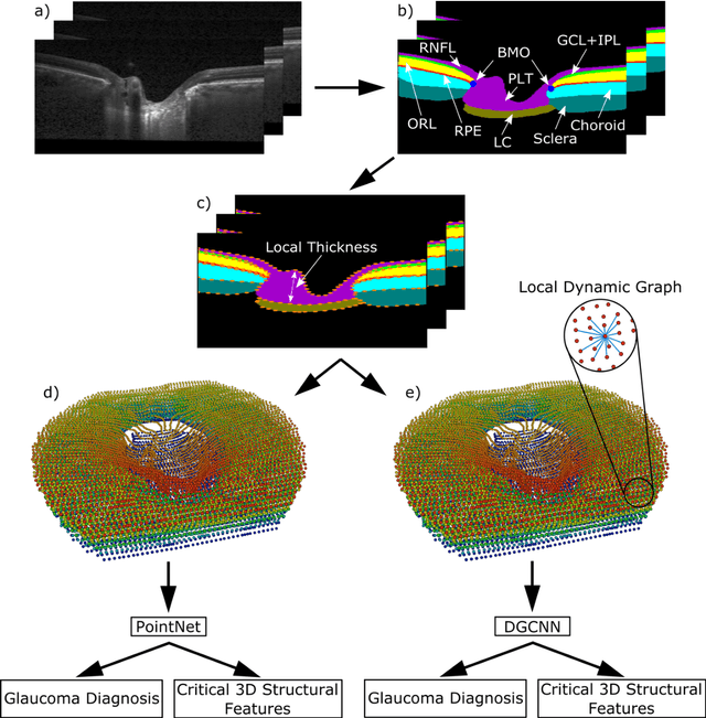 Figure 1 for Geometric Deep Learning to Identify the Critical 3D Structural Features of the Optic Nerve Head for Glaucoma Diagnosis