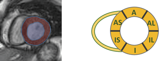 Figure 1 for Direct Estimation of Regional Wall Thicknesses via Residual Recurrent Neural Network