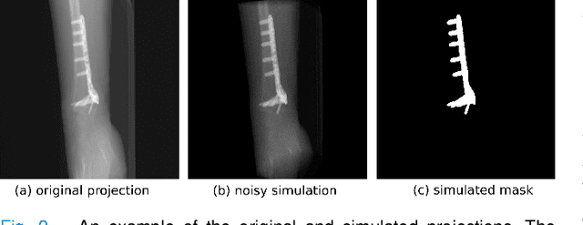 Figure 2 for Metal artifact correction in cone beam computed tomography using synthetic X-ray data