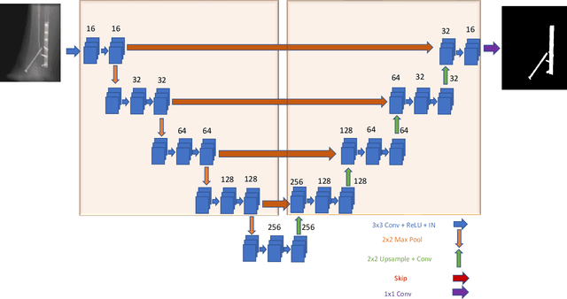 Figure 3 for Metal artifact correction in cone beam computed tomography using synthetic X-ray data
