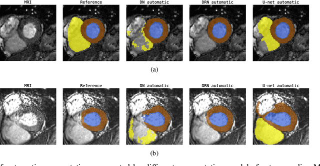 Figure 2 for Automatic segmentation with detection of local segmentation failures in cardiac MRI