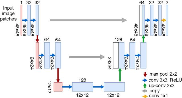 Figure 3 for Parametric Scaling of Preprocessing assisted U-net Architecture for Improvised Retinal Vessel Segmentation