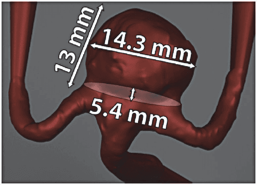 Figure 3 for An Optical Flow-Based Approach for Minimally-Divergent Velocimetry Data Interpolation