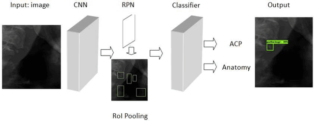 Figure 1 for Atherosclerotic carotid plaques on panoramic imaging: an automatic detection using deep learning with small dataset