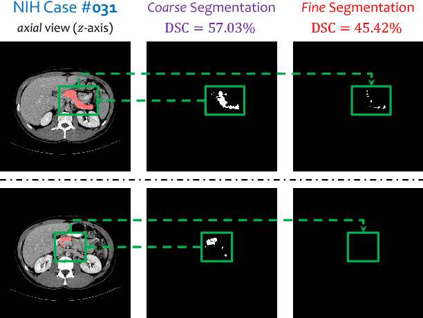 Figure 3 for Recurrent Saliency Transformation Network: Incorporating Multi-Stage Visual Cues for Small Organ Segmentation