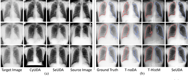 Figure 3 for Semantic-Aware Generative Adversarial Nets for Unsupervised Domain Adaptation in Chest X-ray Segmentation