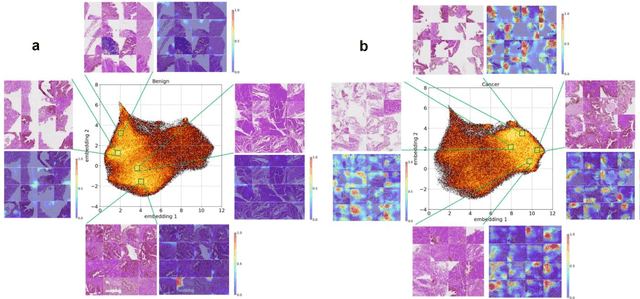 Figure 2 for Using deep learning to detect patients at risk for prostate cancer despite benign biopsies