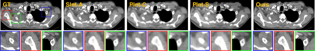 Figure 3 for Incremental Cross-view Mutual Distillation for Self-supervised Medical CT Synthesis