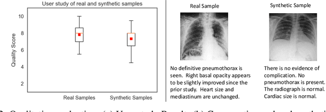 Figure 4 for EMIXER: End-to-end Multimodal X-ray Generation via Self-supervision