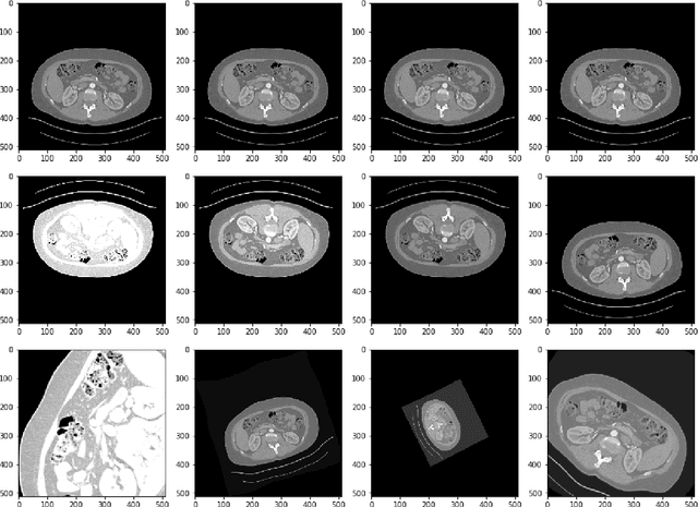 Figure 2 for Multi-Scale Supervised 3D U-Net for Kidneys and Kidney Tumor Segmentation