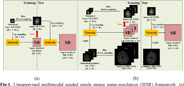 Figure 1 for Unsupervised MRI Super-Resolution using Deep External Learning and Guided Residual Dense Network with Multimodal Image Priors