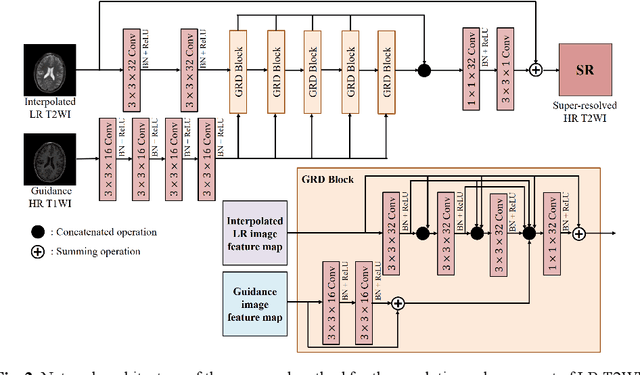 Figure 3 for Unsupervised MRI Super-Resolution Using Deep External Learning and Guided Residual Dense Network with Multimodal Image Priors