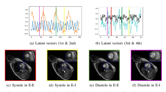 Figure 2 for Dynamic imaging using deep generative SToRM (Gen-SToRM) model