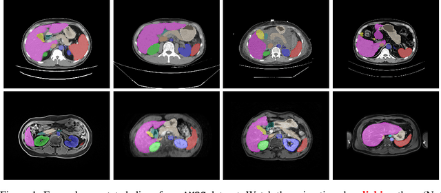 Figure 1 for AMOS: A Large-Scale Abdominal Multi-Organ Benchmark for Versatile Medical Image Segmentation