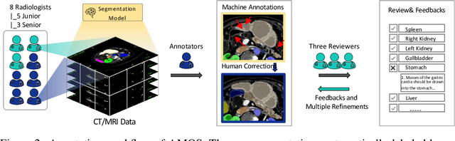 Figure 3 for AMOS: A Large-Scale Abdominal Multi-Organ Benchmark for Versatile Medical Image Segmentation