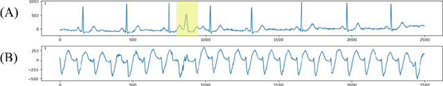 Figure 1 for Using Multitask Learning to Improve 12-Lead Electrocardiogram Classification