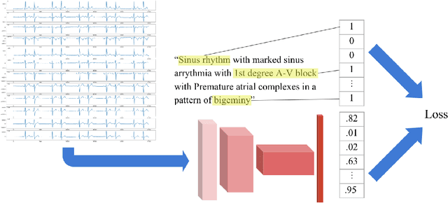 Figure 3 for Using Multitask Learning to Improve 12-Lead Electrocardiogram Classification