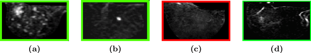 Figure 4 for Unsupervised Task Design to Meta-Train Medical Image Classifiers