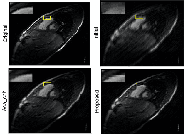 Figure 3 for Active Sampling for Accelerated MRI with Low-Rank Tensors