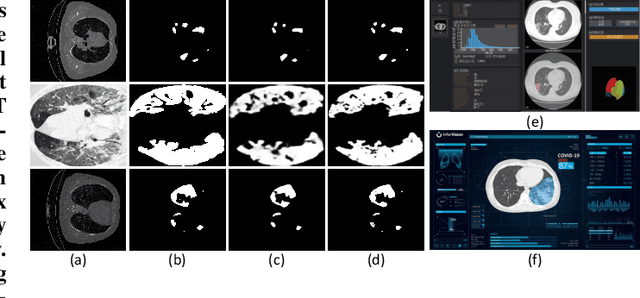 Figure 1 for Boundary Guided Semantic Learning for Real-time COVID-19 Lung Infection Segmentation System