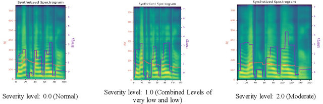 Figure 3 for Synthesizing Dysarthric Speech Using Multi-talker TTS for Dysarthric Speech Recognition