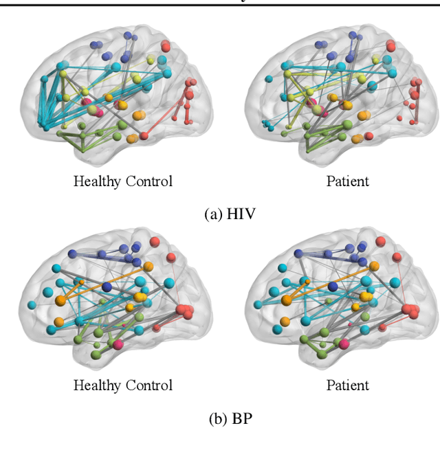 Figure 3 for BrainNNExplainer: An Interpretable Graph Neural Network Framework for Brain Network based Disease Analysis