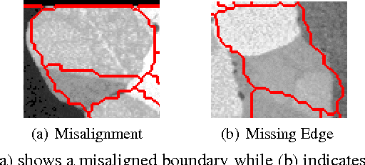 Figure 1 for Coercive Region-level Registration for Multi-modal Images