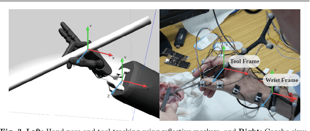 Figure 4 for Mapping Surgeon's Hand/Finger Motion During Conventional Microsurgery to Enhance Intuitive Surgical Robot Teleoperation