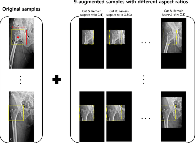 Figure 3 for Look at here : Utilizing supervision to attend subtle key regions