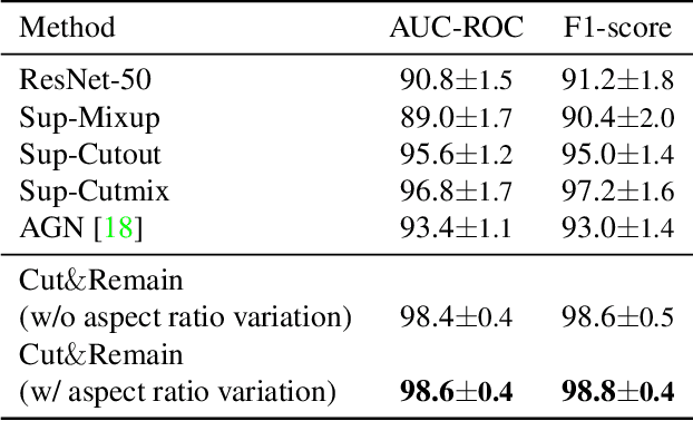 Figure 4 for Look at here : Utilizing supervision to attend subtle key regions