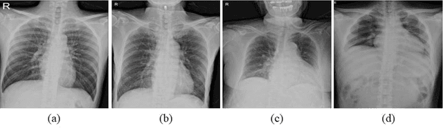 Figure 4 for Deep Learning-based Four-region Lung Segmentation in Chest Radiography for COVID-19 Diagnosis