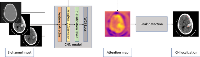 Figure 1 for Weakly supervised deep learning-based intracranial hemorrhage localization