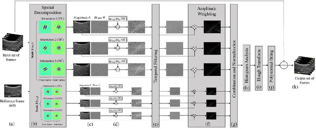 Figure 3 for Medical Instrument Detection in Ultrasound-Guided Interventions: A Review